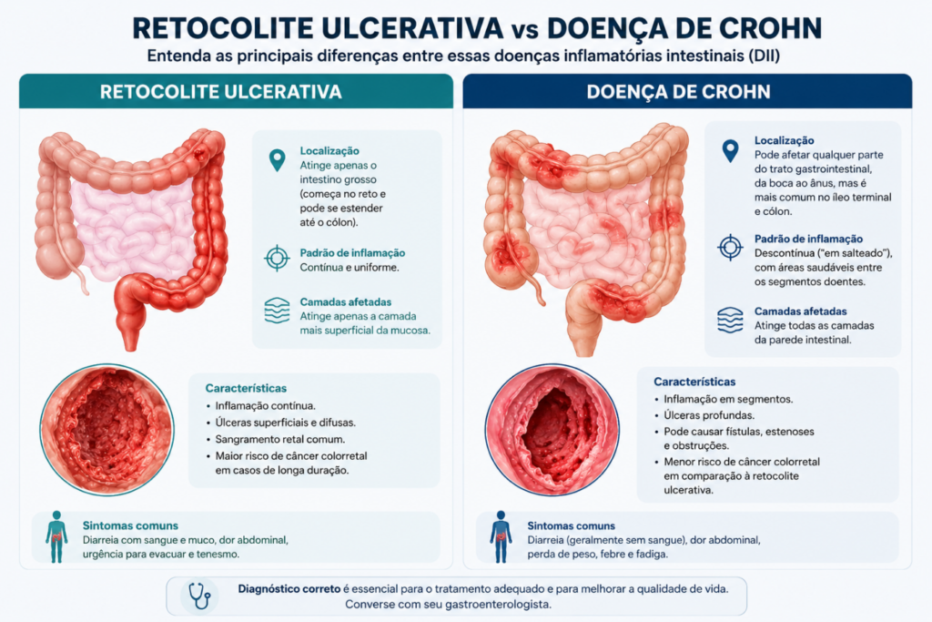 Doenças Inflamatórias Intestinais